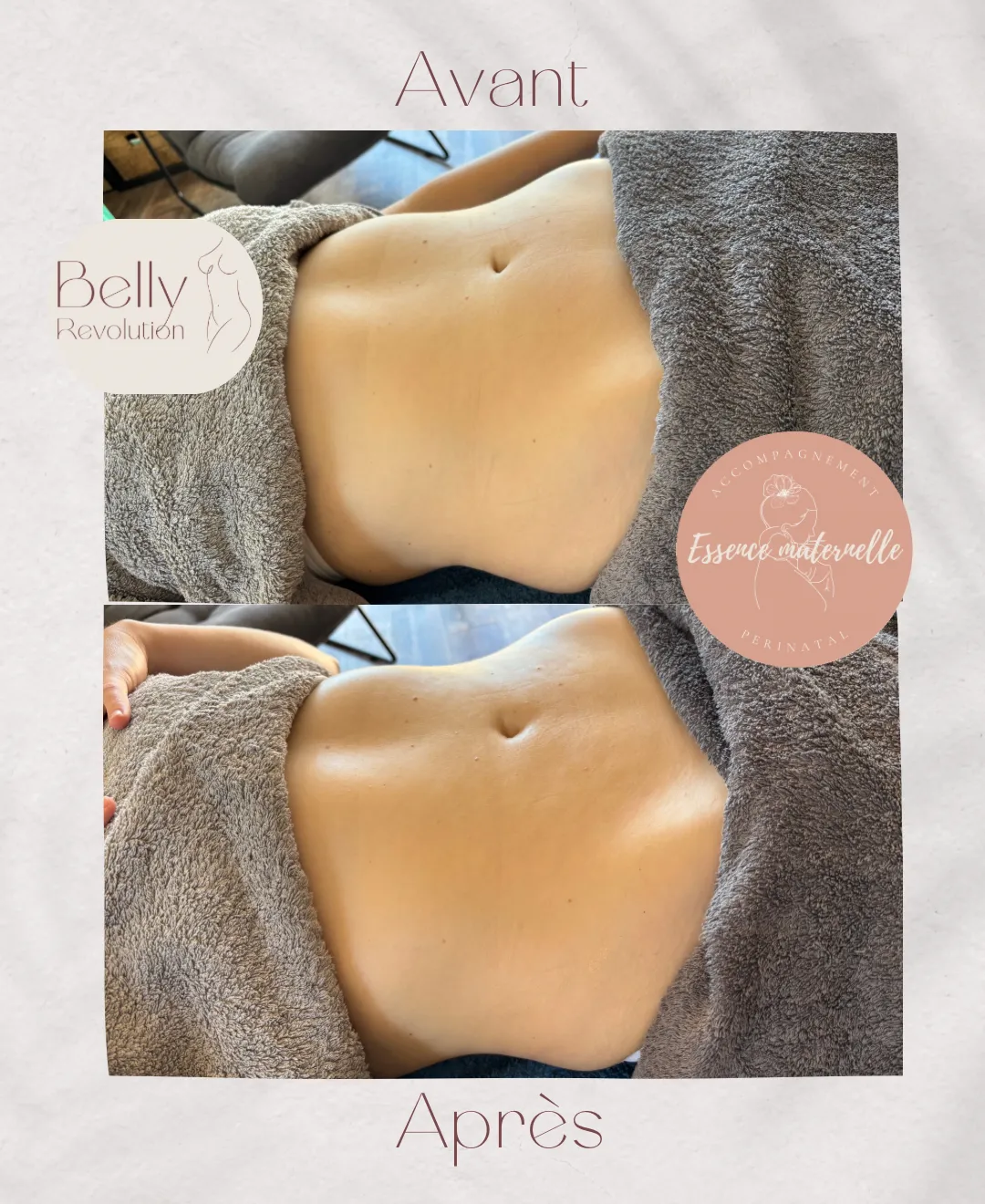 Séance de massage Belly Revolution®